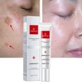 Youbuy Freckle Whitening Cream 20g Pigmentation Remover Dark Spot Remover Anti Freckles Whitening Cream. 