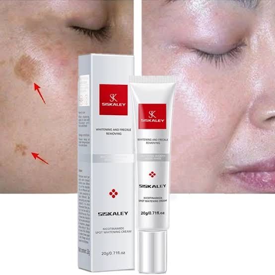 Youbuy Freckle Whitening Cream 20g Pigmentation Remover Dark Spot Remover Anti Freckles Whitening Cream
