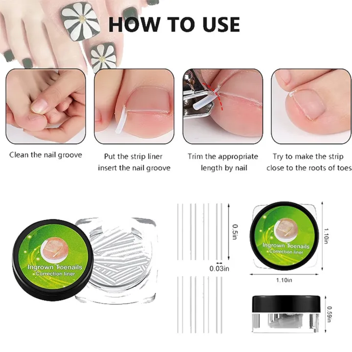 10PCS%20Ingrown%20Toenail%20Correction%20Tool%20Nail%20Treatment%20Toe%20Nail%20Sticker%20Foot%20Care%20Pedicure%20Foot%20Orthodontic%20Toe%20Thumb%20Nail%20Patches%20-%20Image%202