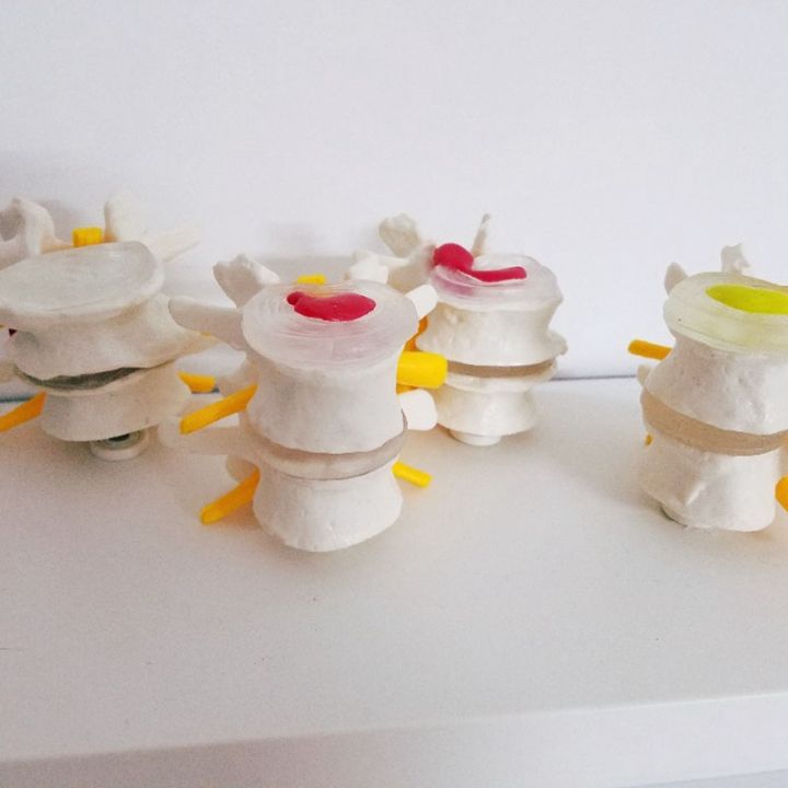 Individual%20Human%20Anatomy%20Skeleton%20Spine%204-Stages%20Lumbar%20Vertebral%20Model%20Brain%20Skull%20Traumatic%20Teaching%20Supplies%20-%20Image%204