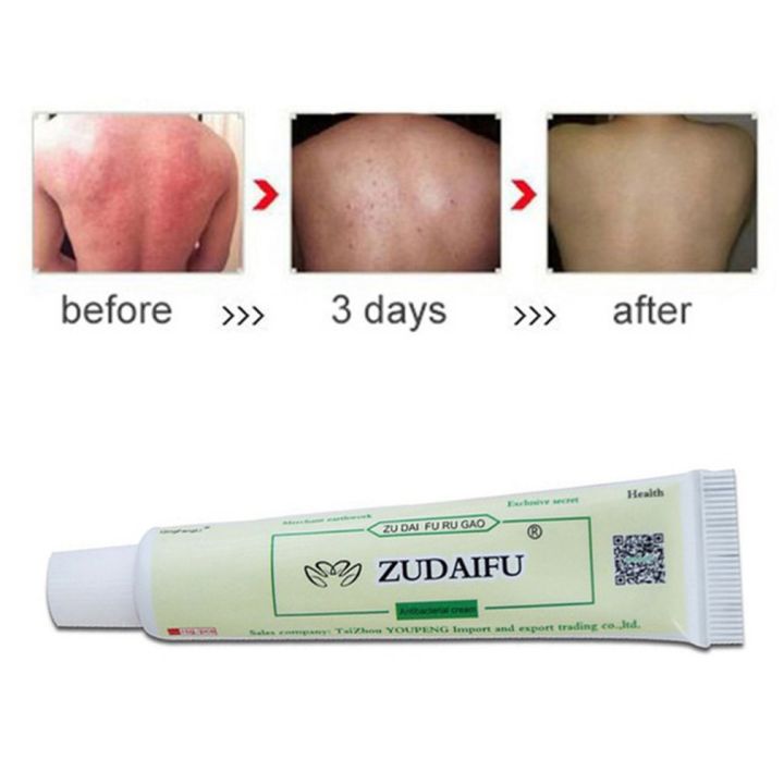 (New)%20zudaifu%20antibacterial%20ointment%20creams%20Psoriasis%20Eczema%20peeling%20herbal%20cream%20beige%20&%20Green%20-%20Image%204