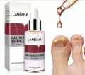 LANBENA Nail Repair Essence Serum - 12ml. 