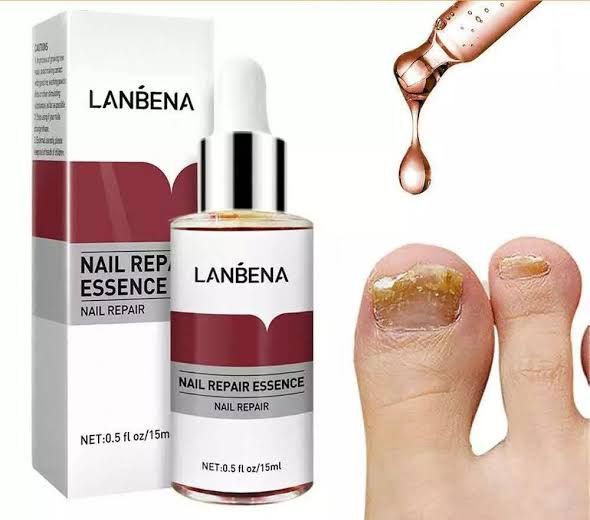 LANBENA%20Nail%20Repair%20Essence%20Serum%20-%2012ml%20-%20Image%203