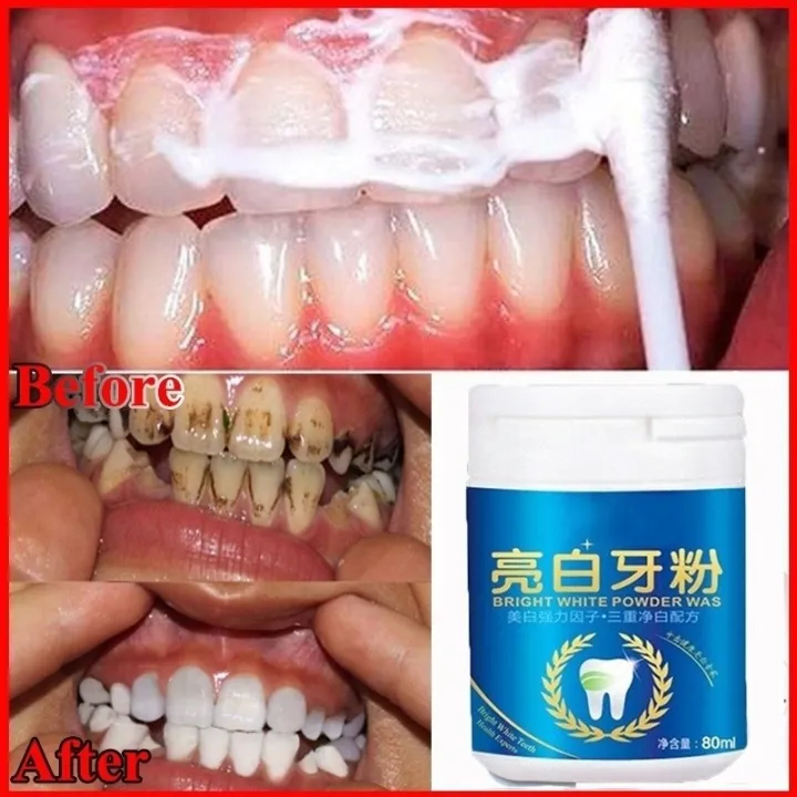 80ml%20Magic%20Natural%20Teeth%20Whitening%20Powder%20Pearl%20Tooth%20Brushing%20Powder%20Physical%20Teeth%20Whitener%20Detoxifying%20Whitening%20Oralh%20Dental%20Oral%20Hygiene%20-%20Image%203