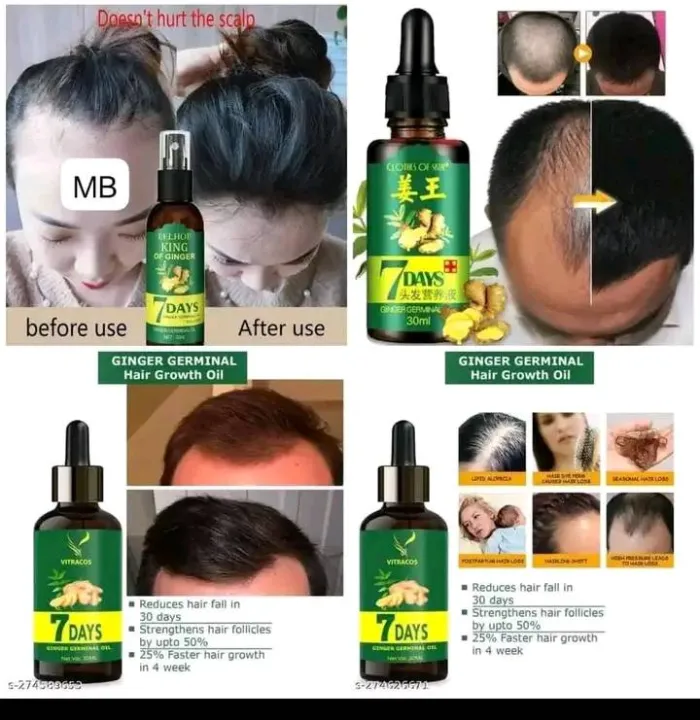 Organic%20Ginger%20Oil%20China%20Ginger%20Hair%20Growth%20Serum%20Sprayer%20Fast%20Hair%20Growth%20Dense%20Regrowth%20Ginger%20Serum%20Oil%20Natural%20Hair%20Growth%20Accelerator%20For%20Stronger%20-%20Image%204