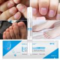 Gentle ingredients skin friendly and no side effect 3ML Fungal Nail Treatment Pen Onychomycosis Paronychia Anti Fungal Nail Infection Chinese Herbal. 