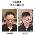 Wig men s short hair Korean version handsome head replacement hair weaving men s real hair bald high forehead breathable.