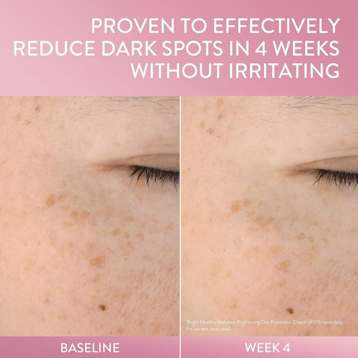 Cetaphil%20Bright%20Healthy%20Radiance%20Brightness%20Reveal%20Creamy%20Cleanser%20100ml%20-%20Image%206