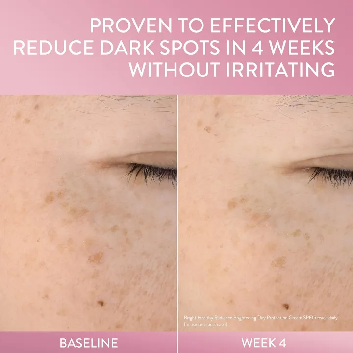 Cetaphil%20Bright%20Healthy%20Radiance%20Brightness%20Reveal%20Creamy%20Cleanser%20100ml%20-%20Image%206