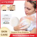 Anti Back Acne Soap Remove Pimple Oil Control Reduce Mite Anti Inflammation Deep Cleansing Acne Treatment Moisture Whiten Soap. 