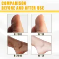 ellow Peeling Oil Extra Strength, Super Strength Yellow Peeling Oil Lightening Exfoliating, Butter Peeling for Dark Skin, Body, Face, Dark Spots, Brightening Complexion.