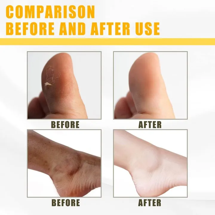 ellow%20Peeling%20Oil%20Extra%20Strength,%20Super%20Strength%20Yellow%20Peeling%20Oil%20Lightening%20Exfoliating,%20Butter%20Peeling%20for%20Dark%20Skin,%20Body,%20Face,%20Dark%20Spots,%20Brightening%20Complexion%20-%20Image%202
