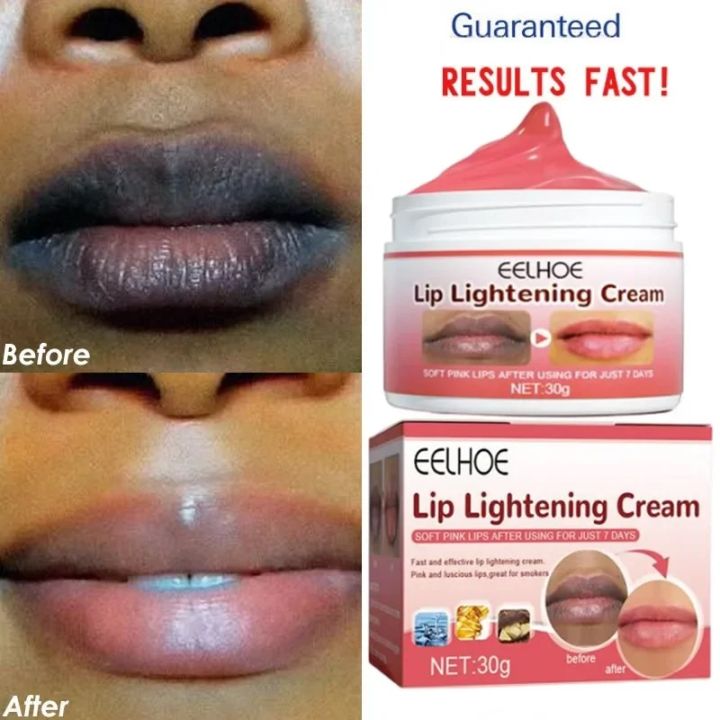 Lip%20Lightening%20Dark%20Lips%20Bleach%20Lips%20Whiten%20Remove%20Dull%20Black%20Lip%20Deep%20Nourish%20Fade%20Lip%20Lines%20Moisturize%20Bright%20-%20Image%203