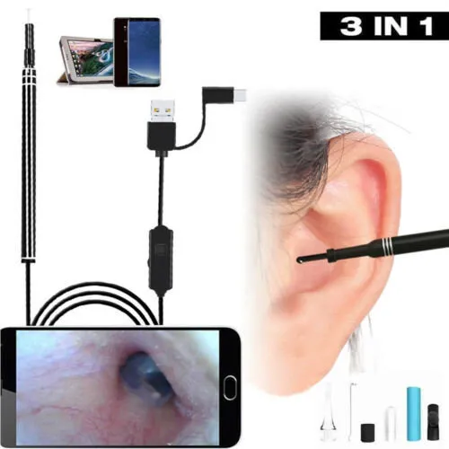 USB%20Otoscope-Ear%20Endoscope%20Diameter%20Visu%20Waterproof%20HD%20Ear%20Camera%20with%20Ear%20Tool%20and%206%20Adjustable%20LED%20Lights%20for%20-Android%20and%20Windows%20-%20Image%202