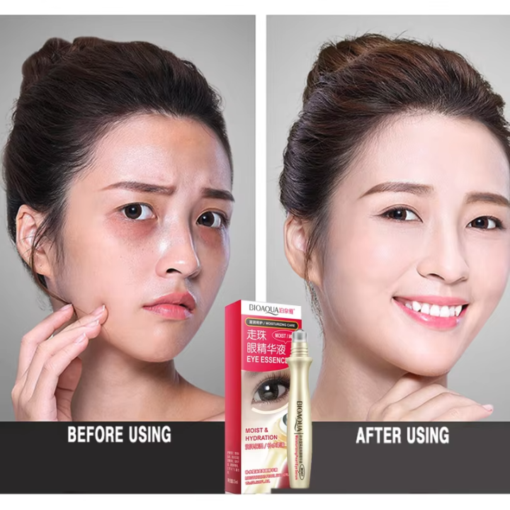 %E3%80%BD%EF%B8%8F%20BIOAQUA%20Dark%20Circle%20Removal%20Bright%20Ball%20Eye%20Essence%20-%2015ml%20-%20Image%204