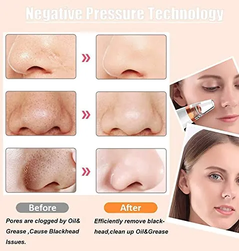 Multi-function Blackhead Remover Electric Derma suction Machine | USB Rechargeable Acne Pimple Pore Cleaner Vacuum tool Facial Cleanser Device for Nose & Skin Care