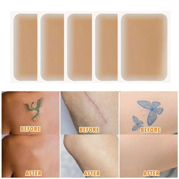 Instantly%20Tattoo%20Scar%20Cover%20Up%20Body%20Flaw%20Concealer%20Patches%20Skin%20Invisible%20Blemish%20Covering%20Sticker%20Waterproof%20Scar%20Treatment%20-%20Image%204