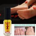Tuojia Essential Oil Removal Of Onychomycosis Care Fungal Nail Toe Oil Infection Anti Paronychia Oil Nail Fungus Tool. 