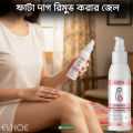EELHOE Scar Removal Cream Gel Burn Surgical Scar Cesarean Scar Repairing Stretch Marks Pigmentation Corrector. 