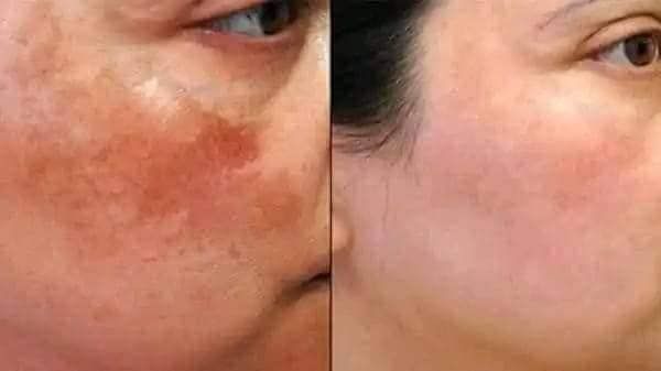 Assure%20Complexion%20%20Bar%20Soap%20Honey%20%20kesor%20&%20olive%20oil%20enriched75g%20India%20-%20Image%204