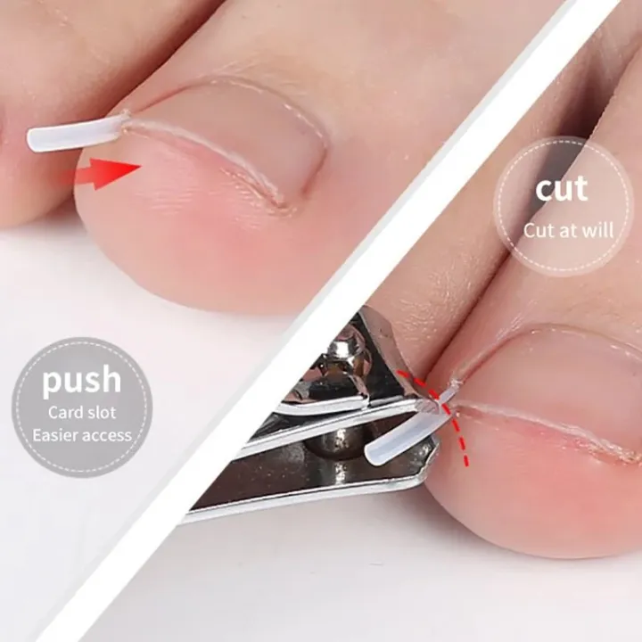 50Pcs%20Ingrown%20Toenail%20Correction%20Tool%20Ingrown%20Toe%20Nail%20Treatment%20Elastic%20Patch%20Sticker%20Straightening%20Clip%20Brace%20Pedicure%20Tool%20-%20Image%204