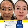 Whitening Freckle Cream Effective Remove Melasma Dark Spots Cream Fade Moisturize Brighten Smooth Beauty Face Care 2024.