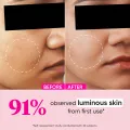 Dot & Key Watermelon 10% Glycolic Serum 30ml for Face Glowing, With Kojic Acid. 