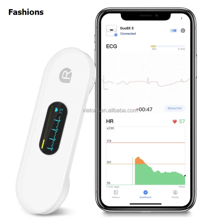 Fashions Pocket ECG Monitoring Device with OLED Screen Bluetooth EKG ...