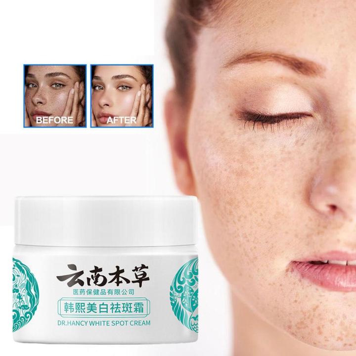 20g%20YunNan%20Herb%20Whitening%20Freckles%20Cream%20Remove%20Melasma%20Fade%20Dark%20Spots%20Shrink%20Pores%20Brightening%20Anti-aging%20Skin%20Care%20Product%20-%20Image%202