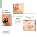 Back Acne Repair Spray Anti Pimples Marks Acne Spots Removal Oil Control Body Whitening Exfoliating Back Pimple Treatment Spray. 