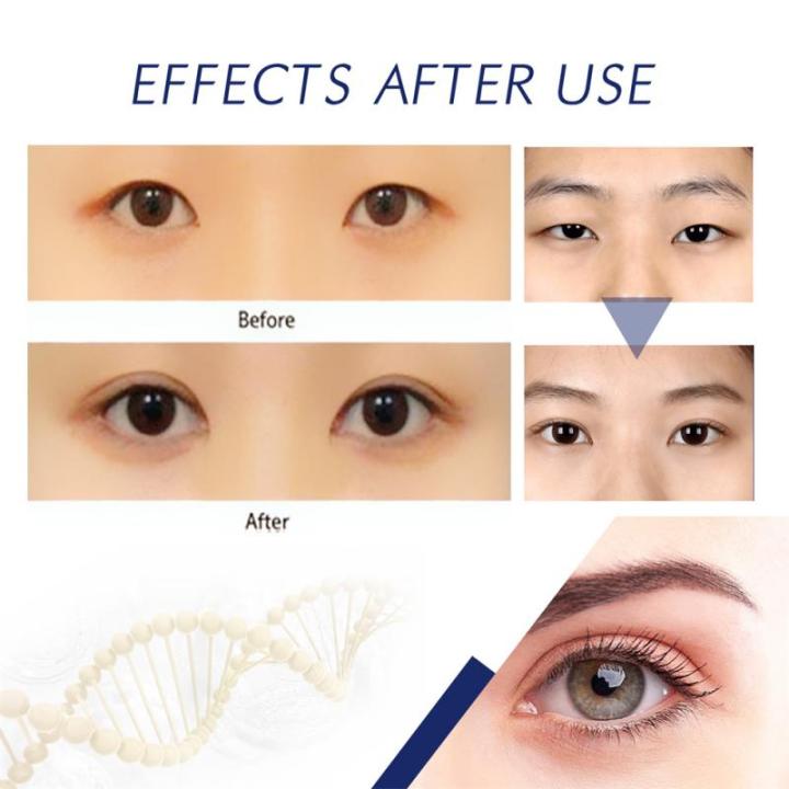 Big%20Eyes%20Double%20Eyelid%20Shaping%20Cream%205ml%20Quick%20Fast%20Dry%20Lift%20Eyelid%20Glue%20Seamless%20Invisible%20Eye%20Makeup%20Beauty%20Tool%20-%20Image%204