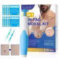 2 In1 Painless Auto Skin Tag Mole Wart Removal Kit Cleaning Tools Face Skin Care Body Wart Dot Treatments Remover Beauty Health Vnce Lncei.