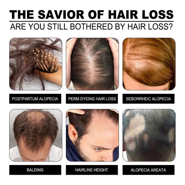 Men%20Beauty%20&%20Health%20Hair%20Growth%20Repair%20Damaged%20Hair%20Fermented%20Rice%20Water%20Serum%20Nourishing%20Hair%20Essential%20Oil%20-%20Image%205
