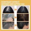 10PCS Gray White Hair Treatment Serum Liquid White To Black Natural Color Repair Nourish Product Anti Loss Hair Care Men Women. 