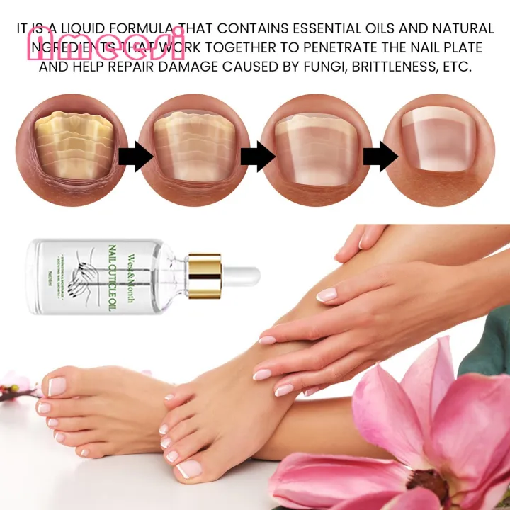 Nail%20Strengthening%20Oil%2015ml%20Nail%20Strengthening%20Cuticle%20Oil%20Repair%20Damaged%20Nails%20Moisturize%20Cuticles%20Natural%20Ingredients%20Fast%20Results%20Damaged%20Nail%20Repair%20Oil%20-%20Image%207