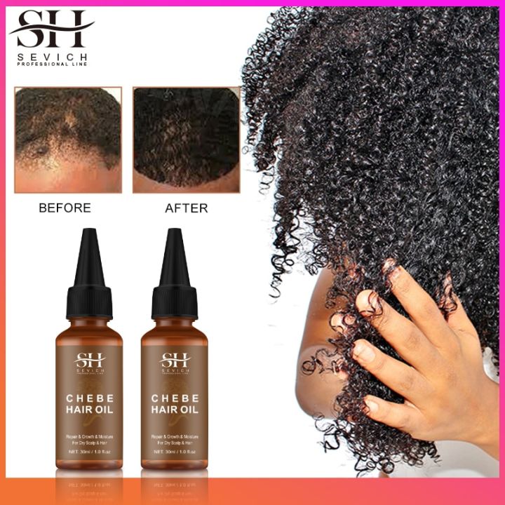Sevich%20Africa%20Traction%20Alopecia%20Chebe%20Hair%20Thickening%20Set%2030ml%20Hair%20Growth%20Oil%20Fast%20Growing%20100g%20Hair%20Butter%20Strong%20Hair%20Root%20-%20Image%208