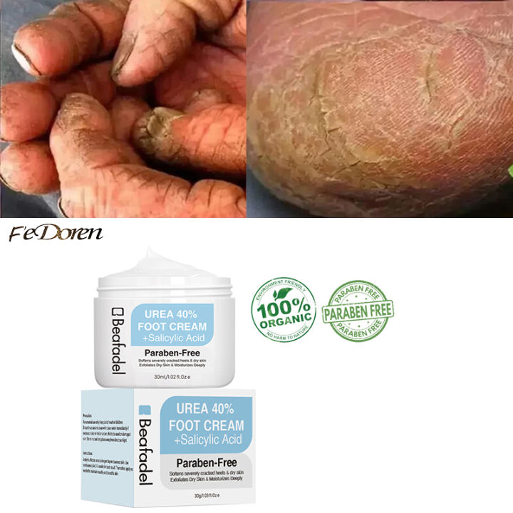 Urea Cream 40% Feet Moisturizing Anti Drying Salicylic Acid Exfoliates Dead Skin Callus Remover Heel Cracked Repair Foot Care