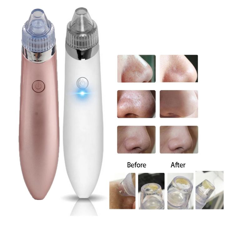 Blackhead Remover Face Deep Pore Cleaner Removal Vacuum Suction Facial SPA Diamond Beauty Care Tool Skin Care Electric Cleaner