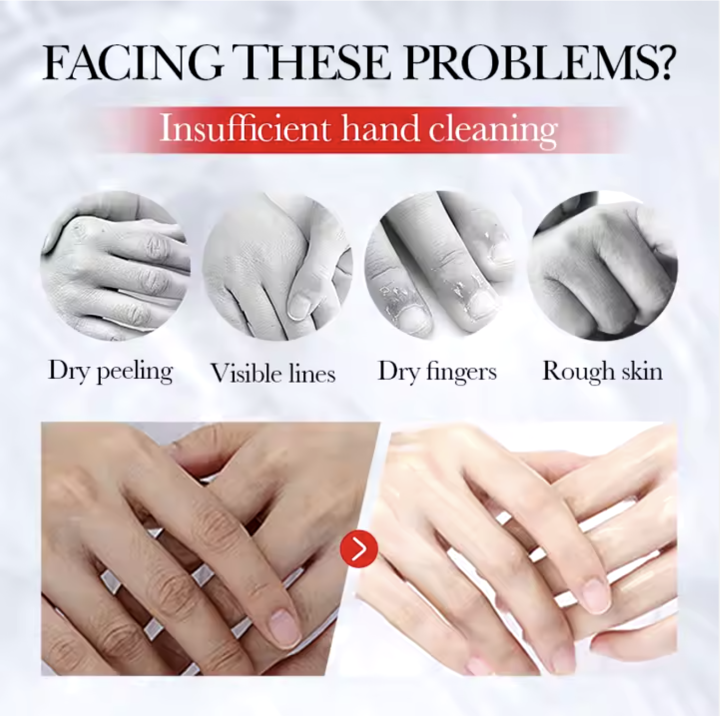 Sadoer%20Kojic%20Acid%20+%20Niacinamide+%20Hyaluronic%20Acid%20Whiten%20Tender%20Hand%20Cream%20Lotion%2030ml%20Korean%20Moisturizing%20&%20Whitening%20All%20Skin%20Portable%20Hand%20Care%20Cream%20-%20Image%205