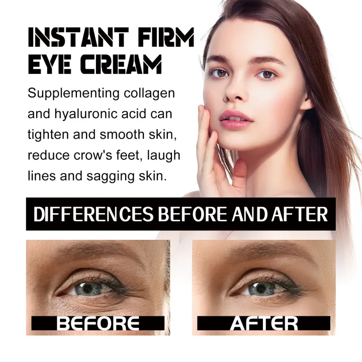 Eelhoe%20Eye%20Firming%20Lifting%20Cream%20Fading%20Wrinkle%20Wrinkle%20Firming%20Moisturizing%20Skin%20Hydrating%20Anti-Wrinkle%20Eye%20Cream%20-%20Image%202