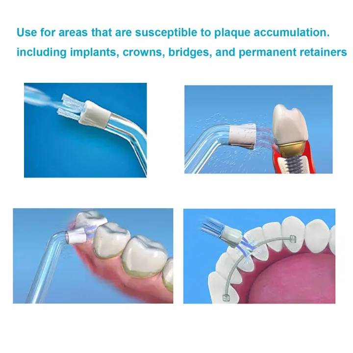 4pcs%20suitable%20for%20waterpik%20dental%20flosser%20oral%20irrigator%20dental%20plaque%20nozzle%20accessories%20WP-100%20WP-450%20WP-250%20WP-300%20WP-660%20-%20Image%206