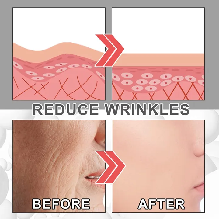 EELHOE%20Women%20Collagen%20Boost%20Anti-Aging%20Serum%20Collagen%20Booster%20for%20Face%20with%20Hyaluronic%20Acid%20Unisex%20Collagen%20Facial%20Cream%20-%20Image%204