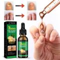 7DAYS Repair Nail Fungus Treatments Essence Foot Care Serum Toe Nails Fungal Removal Gel Anti-Infection Onychomycosis Care Tool. 