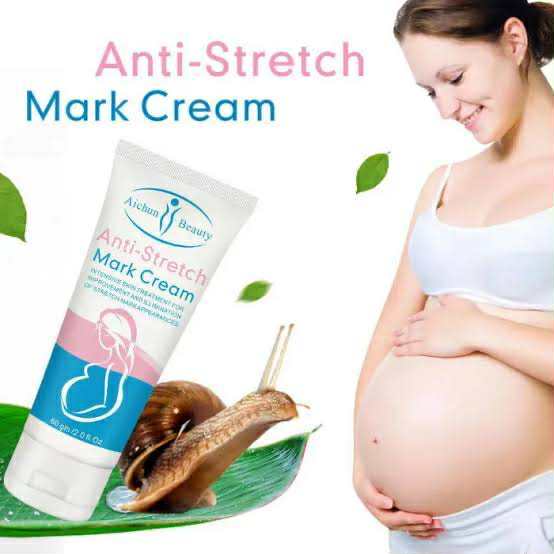 Aichun Beauty Anti-Stretch Marks Cream | Stretch Marks Removal Cream