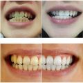 80ml Magic Natural Teeth Whitening Powder Pearl Tooth Brushing Powder Physical Teeth Whitener Detoxifying Whitening Oralh Dental Oral Hygiene. 