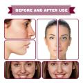 30ml AHA 30% + BHA 2% Face Serum Fruit Acid Acne Oil Control Remove Blackheads Shrink Pores Skin Texture Improve Care. 