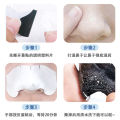 Premium Blackhead & Whitehead Removal Nose Patch – Bamboo Charcoal Deep Cleansing Strip [Imported from China]. 