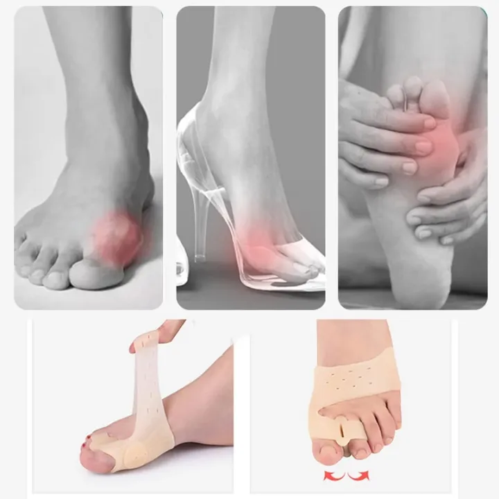 Bunion%20Corrector%20Big%20Toe%20Separator%20Foot%20Pad%20Cushion%20Heel%20Protector%20Insoles%20Valgus%20for%20Toe%20Finger%20Separator%20Feet%20Straightener%20-%20Image%204