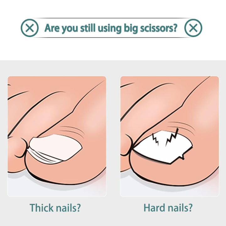 Stainless%20Steel%20Toenail%20Clippers,%20Nail%20Cutter%20for%20Thick%20or%20Ingrown%20Nails%20Nail%20Care%20for%20Men%20Women%20Seniors%20-%20Image%203
