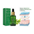 Breylee Acne Treatment Serum Facial - 17 ml. 